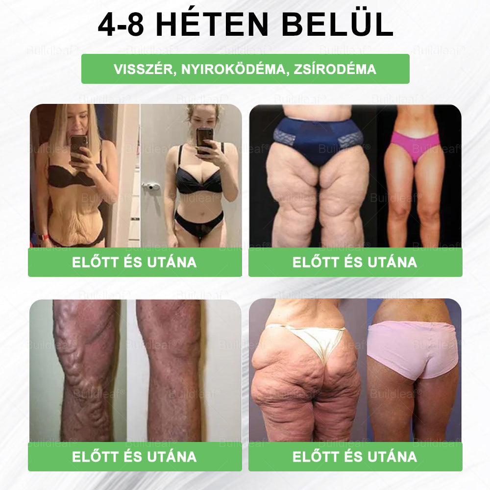 🌱A solução oral BuildLeaf® Berberine GLP-1 Pro para emagrecer pode ajudar a tratar o aumento de peso persistente, problemas metabólicos e energéticos, promovendo um maior bem-estar e vitalidade.