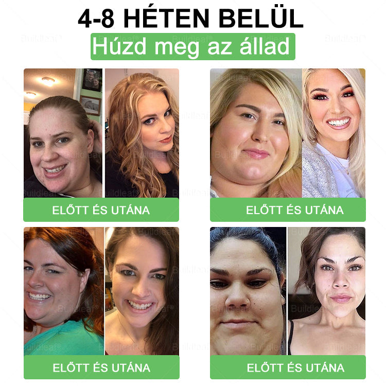 🌱A solução oral BuildLeaf® Berberine GLP-1 Pro para emagrecer pode ajudar a tratar o aumento de peso persistente, problemas metabólicos e energéticos, promovendo um maior bem-estar e vitalidade.
